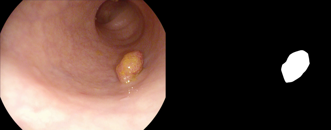 ../_images/etis-larib.png
